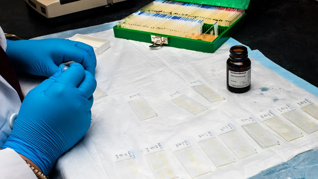 A close-up of hands preparing a row of slides for the microscope