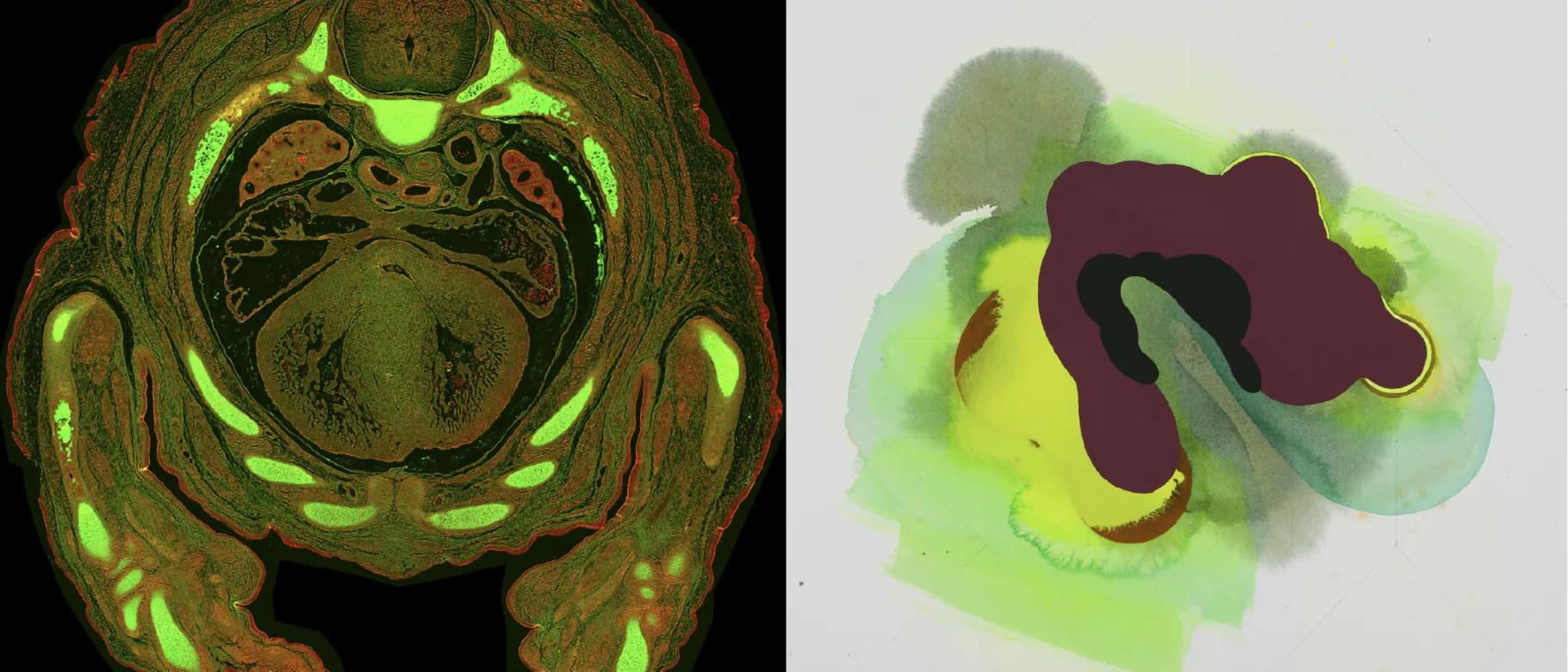 Brain scan images