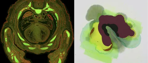 Brain scan images 
